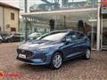 FORD FIESTA 1.1 75 CV GPL 5 porte Titanium