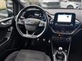 FORD FIESTA 1.0 Ecoboost 125 CV 5 porte ST-Line