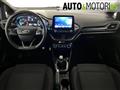 FORD FIESTA 1.5 EcoBlue 5 porte ST-Line