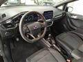 FORD FIESTA 1.0 Ecoboost 100 CV 3P ST-Line