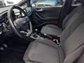 FORD FIESTA 1.0 Ecoboost 125 CV 5 porte ST-Line