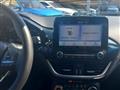 FORD FIESTA 1.1 75 CV 5 porte Titanium con Retrocamera