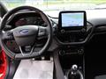 FORD FIESTA 1.5 EcoBlue 5 porte ST-Line " Neopatentati "