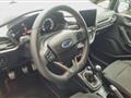 FORD FIESTA 1.5 EcoBlue 5 porte ST-Line