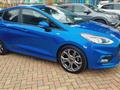 FORD FIESTA 1.5 EcoBlue 5 porte ST-Line