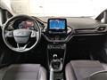 FORD FIESTA 1.5 TDCi 5 porte Vignale