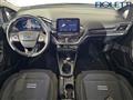 FORD FIESTA 1.0 Ecoboost Hybrid 125 CV 5 porte Active