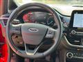 FORD FIESTA 1.1 85 CV 5 porte Titanium