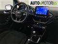 FORD FIESTA 1.5 EcoBlue 5 porte ST-Line