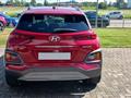 HYUNDAI KONA 1.0 T-GDI Xpossible